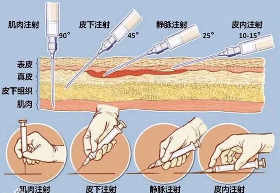 肌肉注射的注射原則